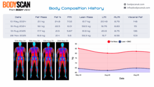 page from my DEXA scan results